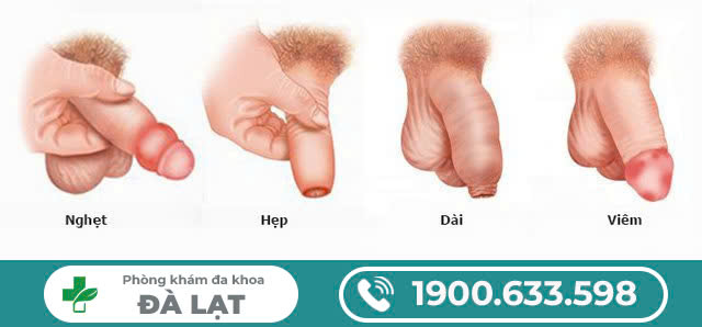 Hình ảnh minh họa